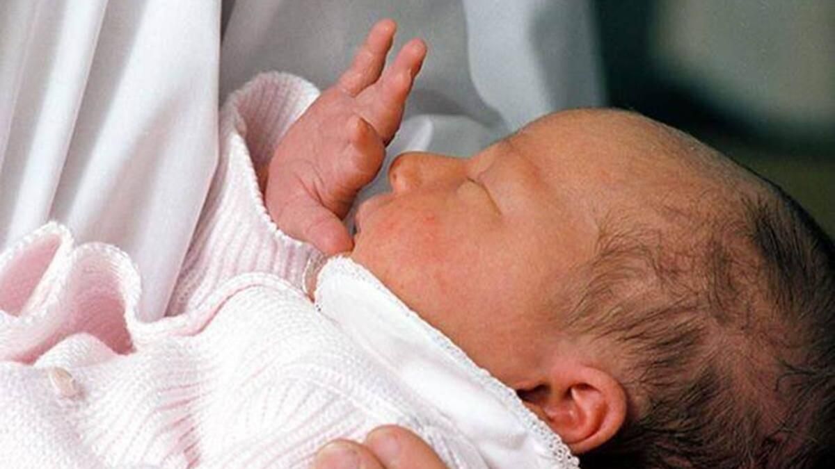 Dubai: Doktorlar 27 Haftalık Prematüre, Kör Bebeğin Vizyonunu Geri Kazandı