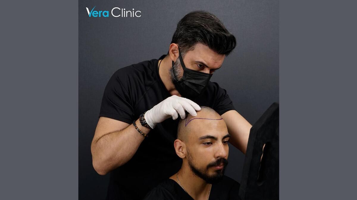 Vera Kliniğinde Mükemmelliğin Özellikleri: Türkiye'nin en iyi Saç Ekimi Kliniği