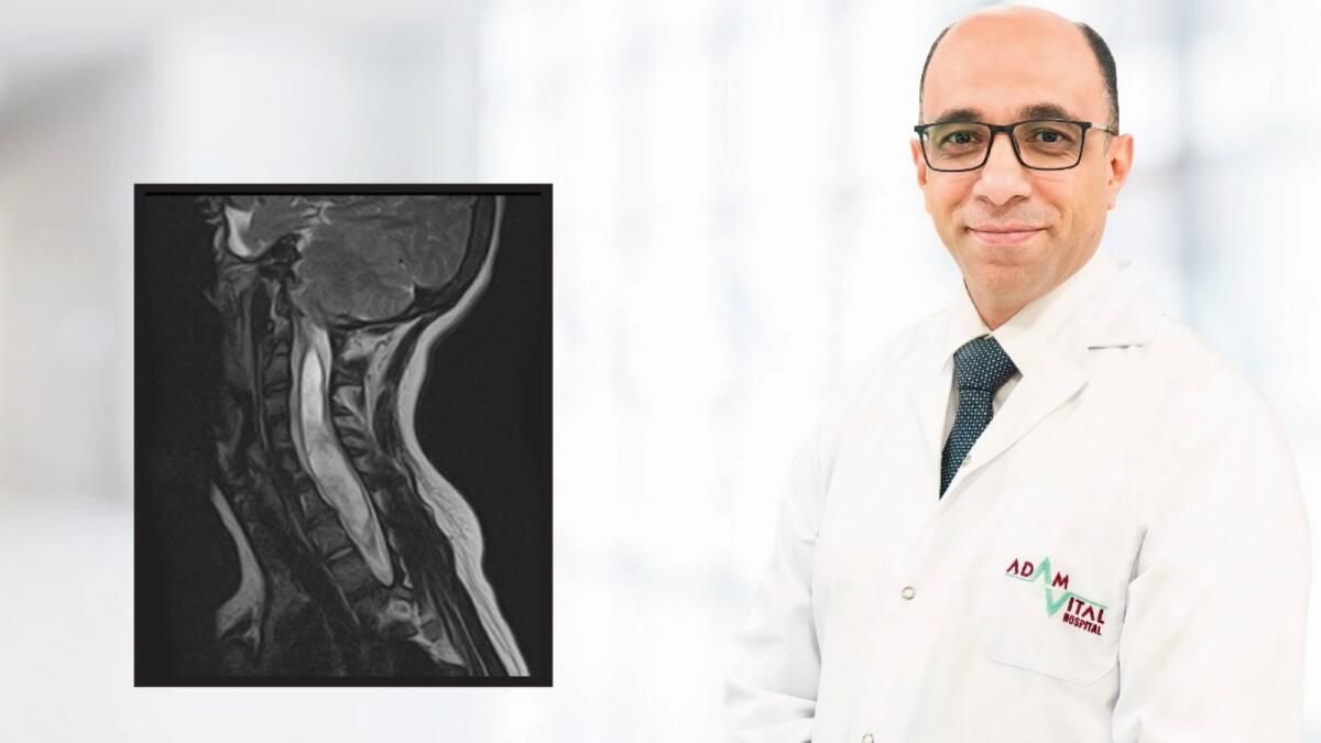 Dubai'de Öncü Ameliyat 13 Yaşındaki Çocuğu Nadir Görülen Omurga Deformitesinden Kurtardı