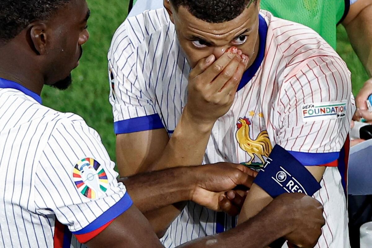 Euro 2024: Avusturya'nın Danso'su Mbappe'nin Kırık Burnu için 'Üzgünüm'