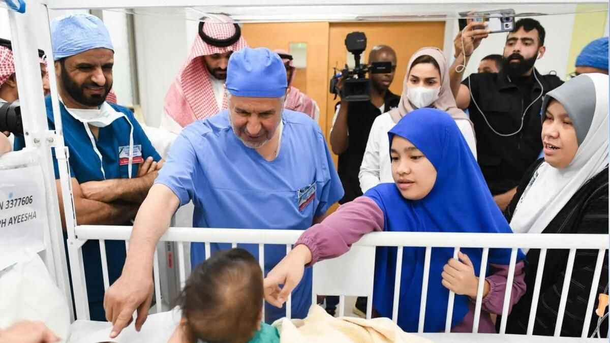 Suudi Arabistan'da 7,5 Saatlik Cerrahi İşlemle Yapışık Filipinli ikizler Ayrılıyor