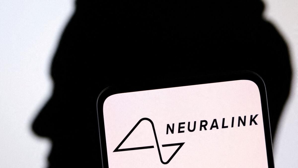 Musk'tan Neuralink, ikinci Deneme İmplantının İyi Gittiğini Söyledi