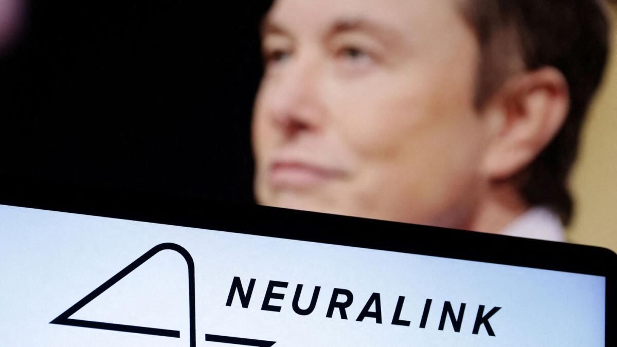 Musk, Neuralink'in Beyin Çipli İkinci Deneme Hastasını İmplante Ettiğini Söylüyor