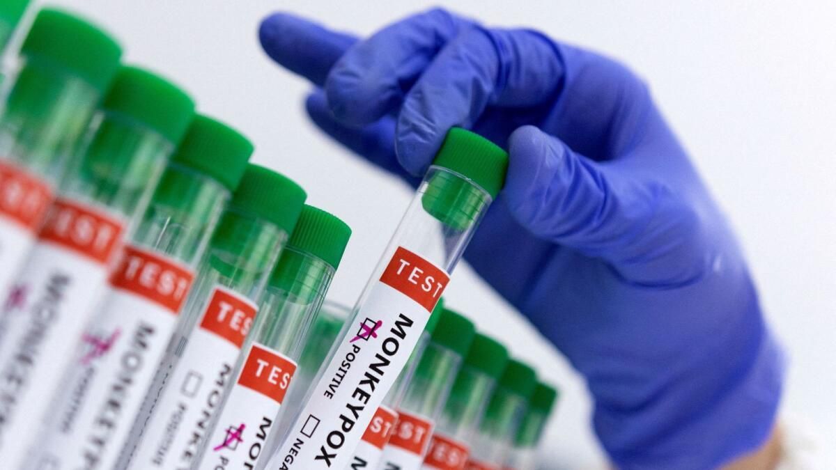 Almanya, Afrika'daki Salgınla Mücadele için 100.000 Mpox Aşı Dozu Bağışlayacak