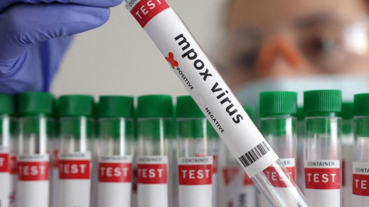 Tayland, Şüpheli Yeni Mpox Suşu Vakasını Bildirdi