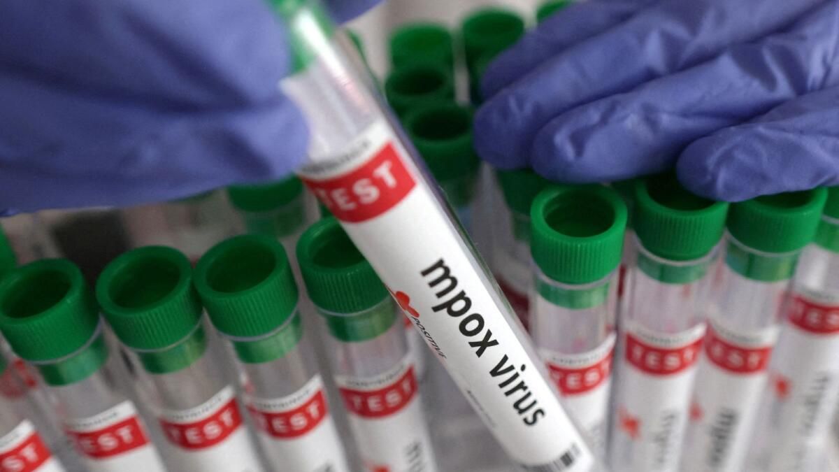 Yeni Mpox Türü Hızla Değişiyor; Afrikalı Bilim Adamları Yanıt Vermek için ’Körü Körüne Çalışıyor'