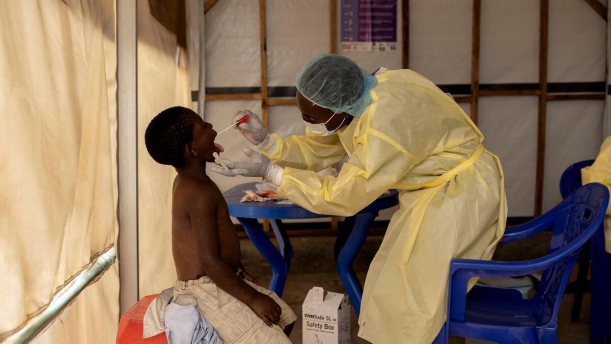 Dsö Başkanı, Mpox'ta Halk Sağlığı Acil Durumu İlan Etmeyi Düşünüyor