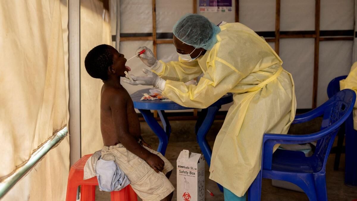 Afrika Halk Sağlığı Kurumu Mpox Acil Durumunu Açıkladı