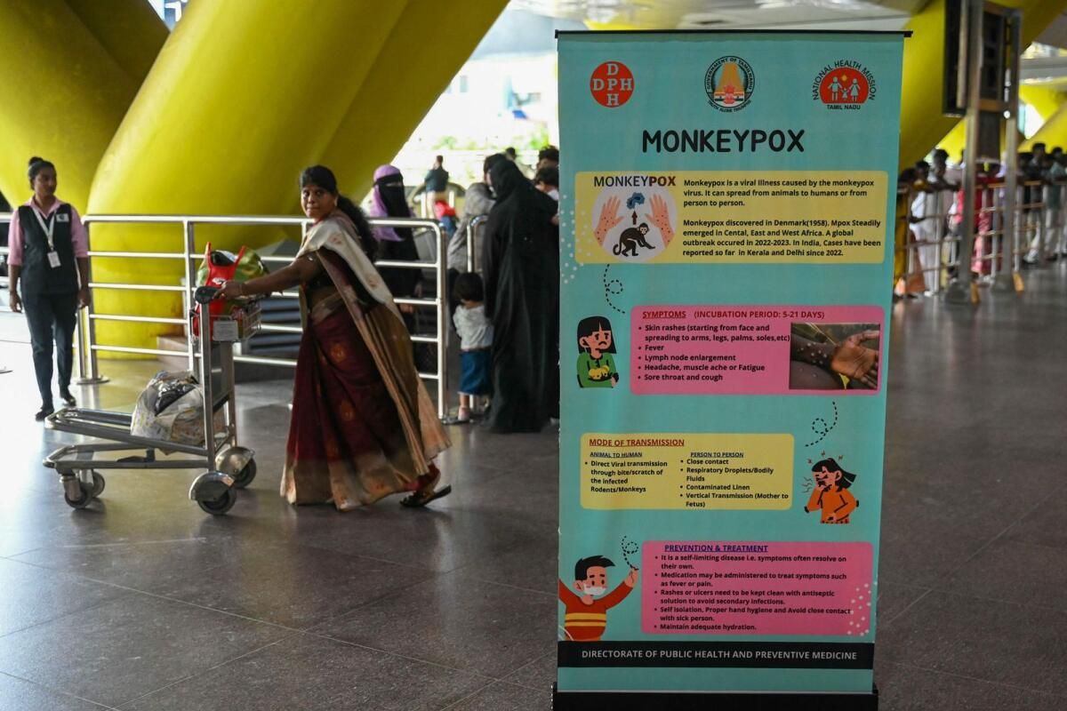 Hindistan, Kerala'da ilk Yeni Mpox Suşu Vakasını Bildirdi