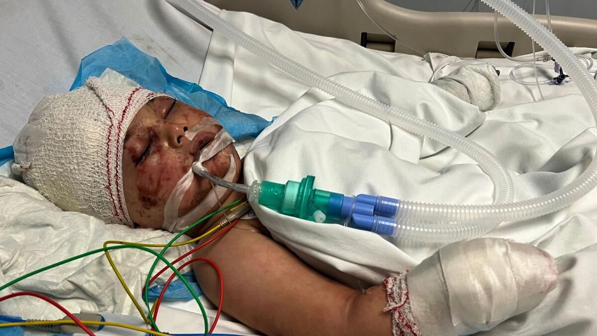 İsrail Saldırısından 14 Saat Sonra Gömülen Lübnanlı Bebek İyileşti