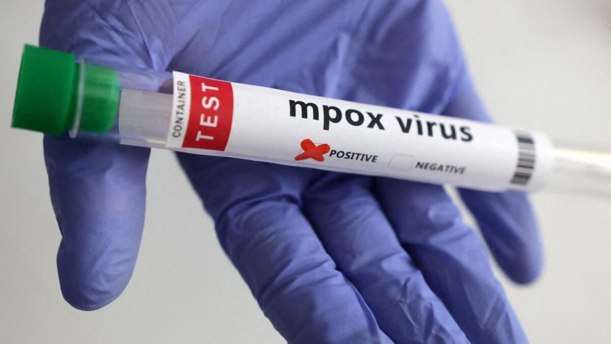 İngiltere iki Yeni Mpox Varyantı Vakası Daha Tespit Etti