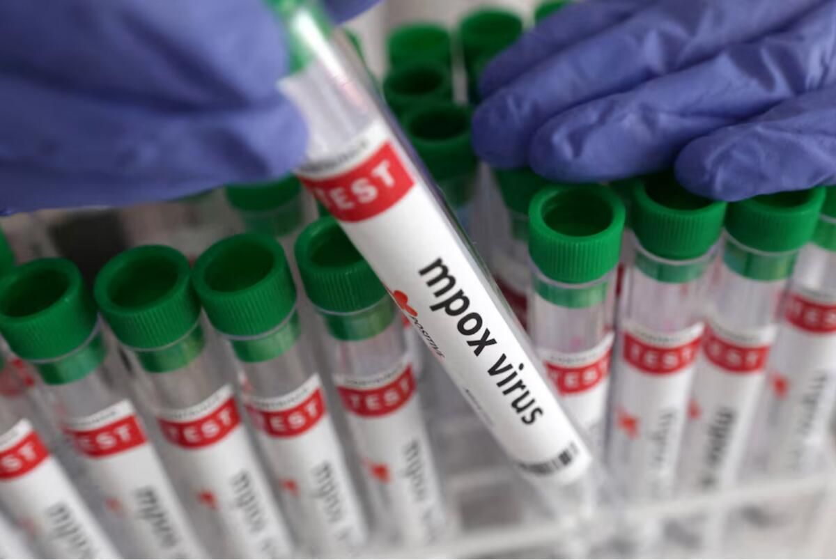 Kanada ilk Clade 1 Mpox Vakasını Doğruladı