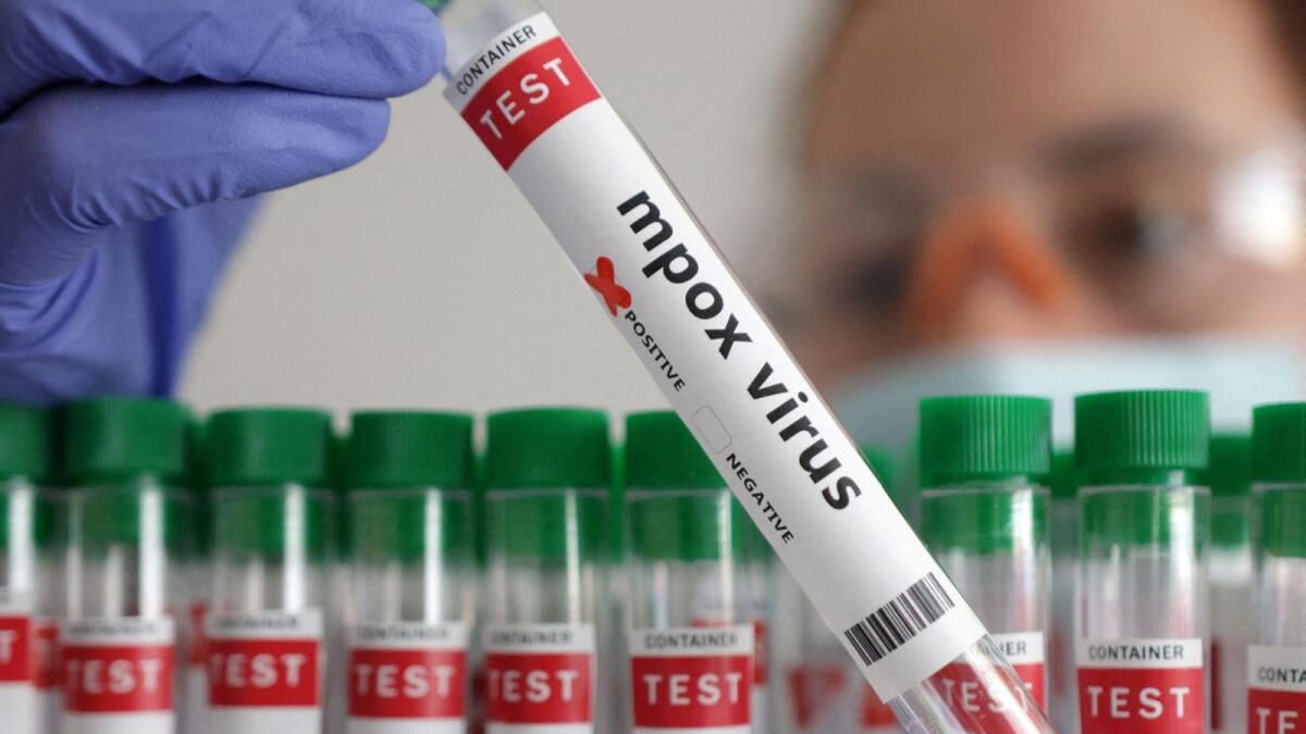 Mpox Virüsü: Pakistan 2025'in ilk Vakasını Bildirdi