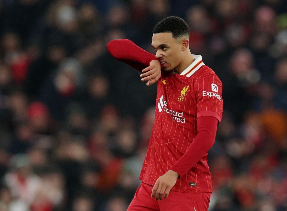 Slot, Manchester United'a Karşı Gösterdiği Kötü Performanstan Sonra Alexander-Arnold'u Savunuyor