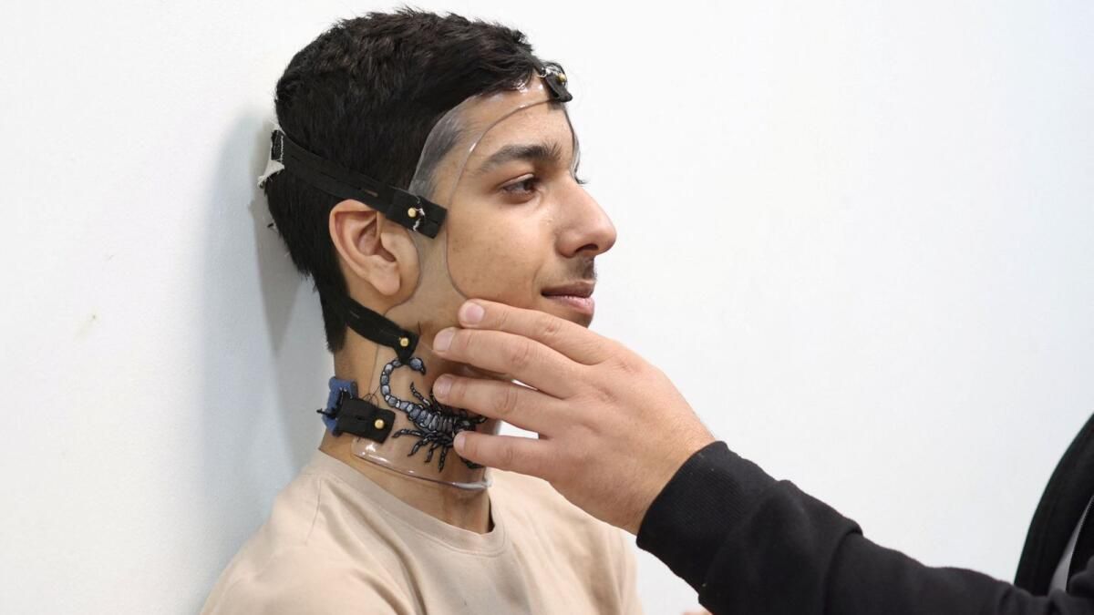 Ürdün'deki Hastane Yaralı Gazzelilere İyileşme Umudu Sunuyor