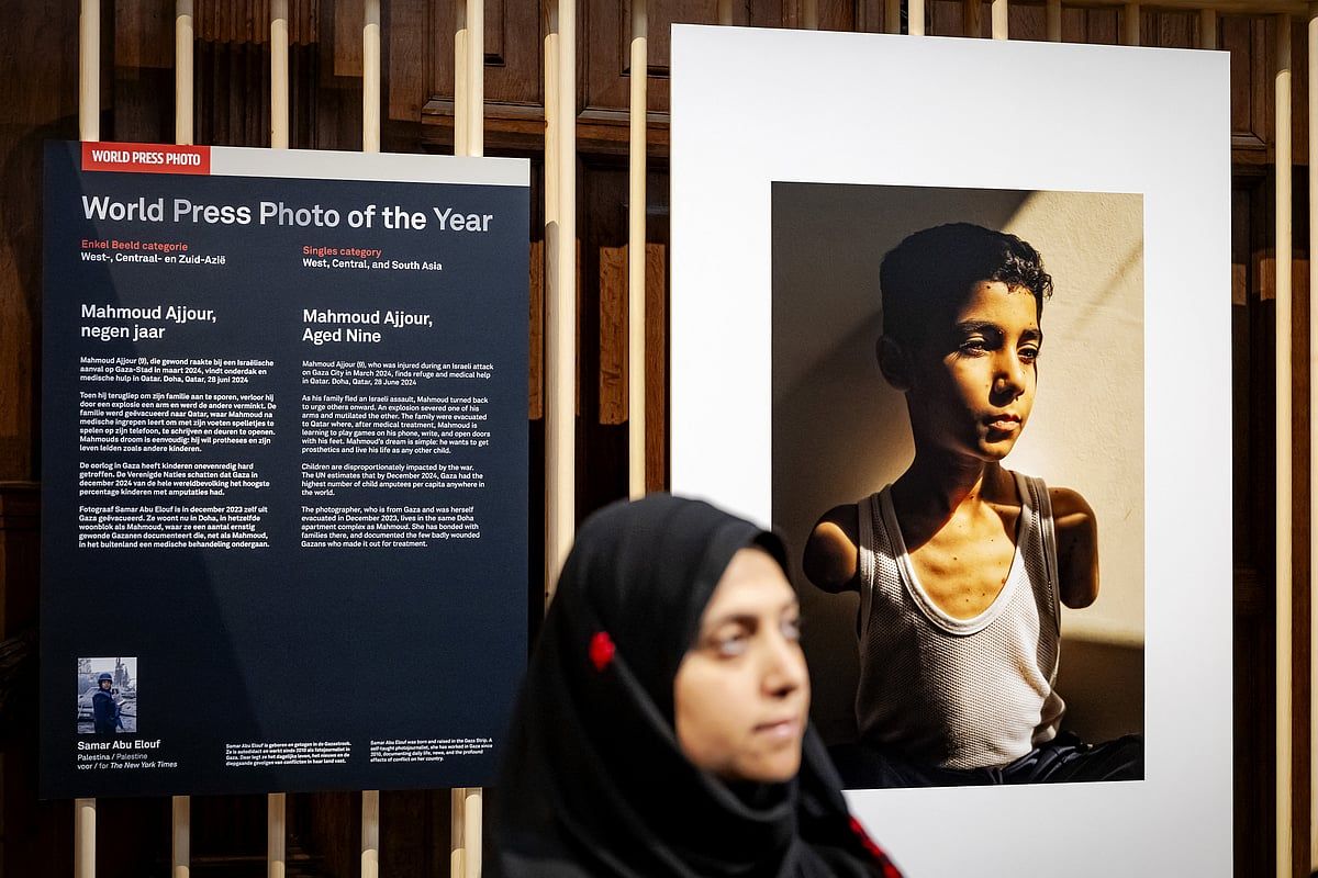 Ampute Filistinli Çocuk İmajı Dünya Basın Fotoğrafı Ödülünü Kazandı