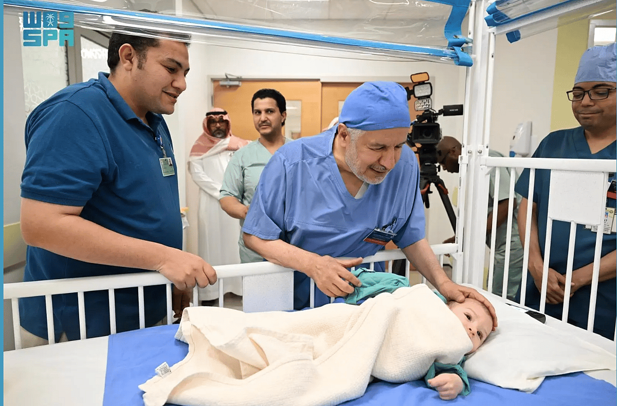 Doktorlar Suudi Arabistan'daki Mısır Parazitik ikizini Ayırmak için Ameliyata Başladı