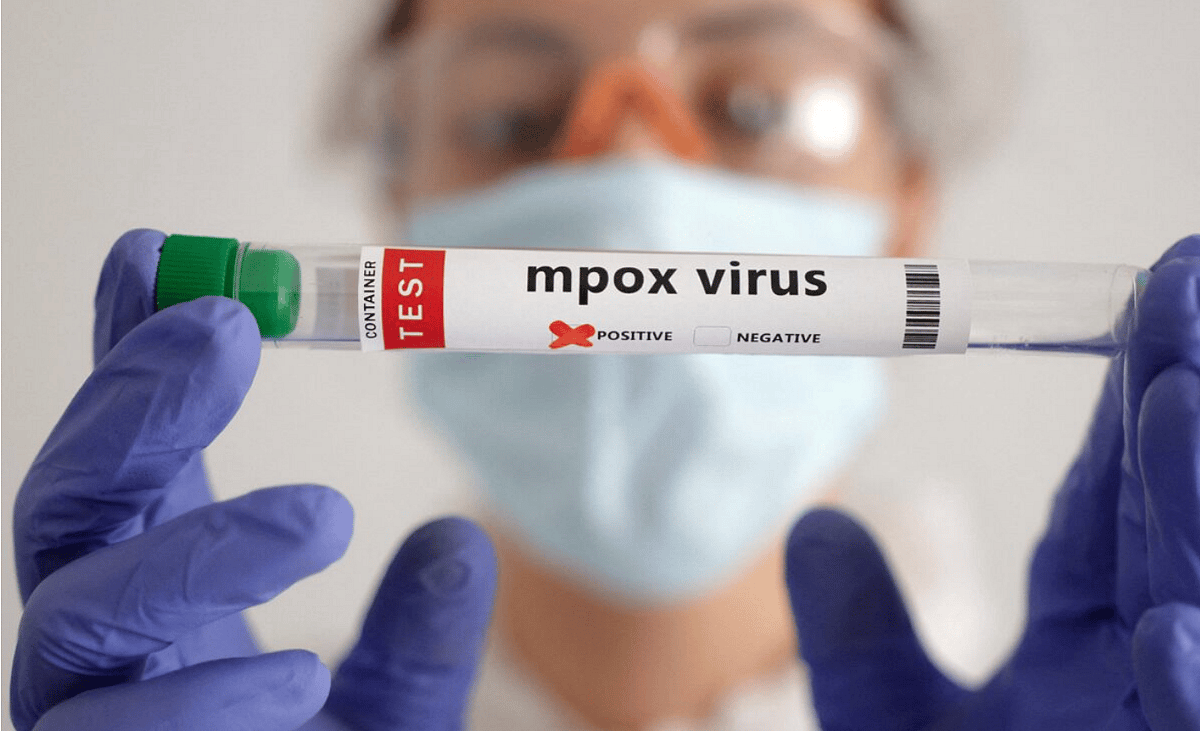 Mpox Virüsü: Pakistan Hayber Bölgesinde 12 Günlük Tecrit İlan Etti